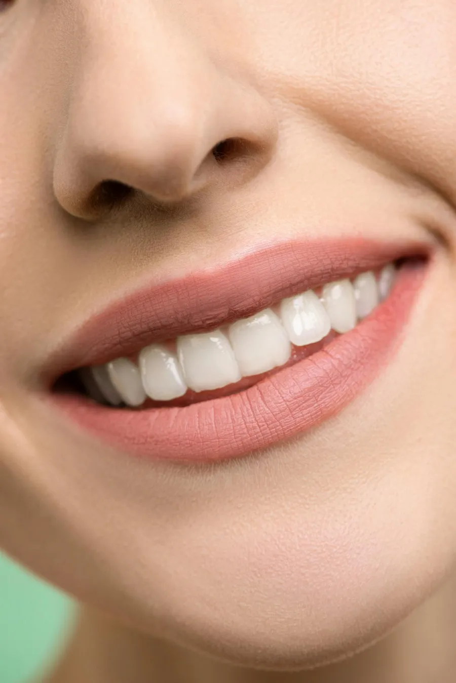 Natural, even smile after composite bonding treatment at Taki Dent
