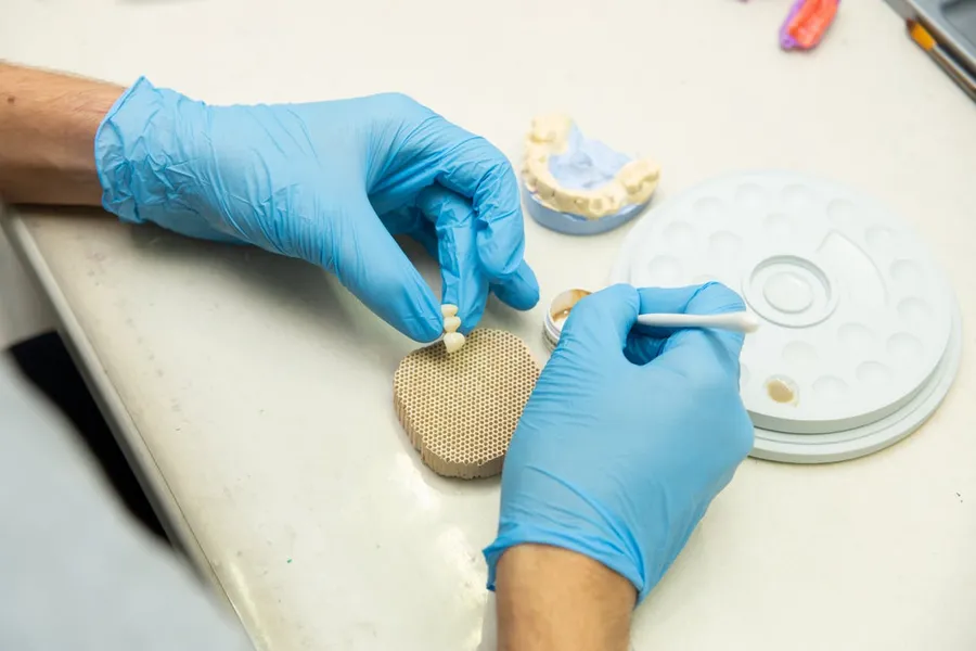 Dental crown fabrication using CAD/CAM technology at a Turkish dental clinic — precision-milled zirconia restorations at Taki Dent