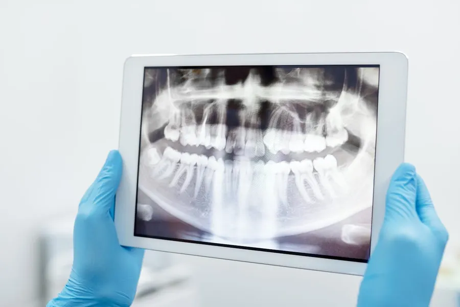 Dentist reviewing dental X-rays on a tablet at Taki Dent — advanced digital imaging technology used for accurate treatment planning and cost estimation for UK patients