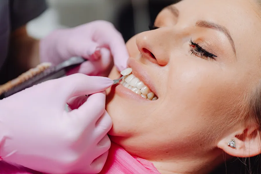 Dentist applying E-max porcelain veneer to a patient's tooth at Taki Dent — precise bonding technique for a natural finish